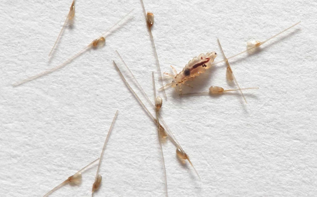 Дезинфекция и обработка от вшей