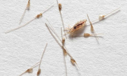 Дезинфекция и обработка от вшей